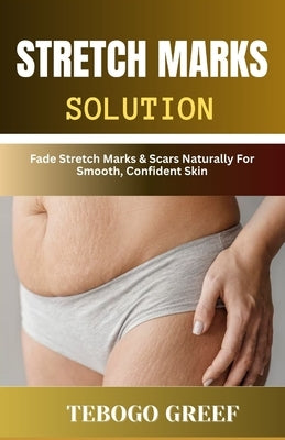 Stretch Marks Solution: Fade Stretch Marks & Scars Naturally For Smooth, Confident Skin by Greef, Tebogo