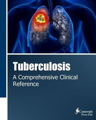 Tuberculosis: A Comprehensive Clinical Reference by Press, Iconcept