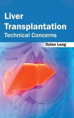 Liver Transplantation: Technical Concerns by Long, Dylan