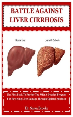 Battle Against Liver Cirrhosis: The First Book To Provide You With A Detailed Program For Reversing Liver Damage Through Optimal Nutrition by Brooke, Susan