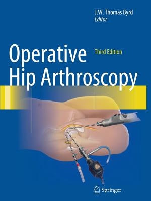 Operative Hip Arthroscopy by Byrd, J. W. Thomas