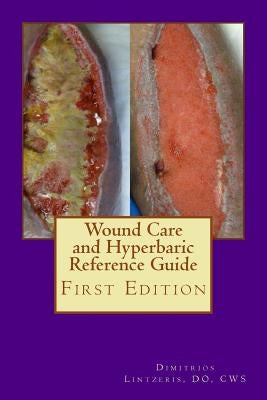 Wound Care and Hyperbaric Reference Guide by Lintzeris Do, Dimitrios P.