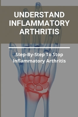 Understand Inflammatory Arthritis: Step-By-Step To Stop Inflammatory Arthritis: Unusual Symptoms Of Rheumatoid Arthritis by Biddleman, Darrin