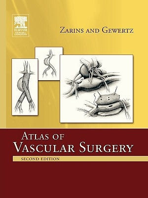 Atlas of Vascular Surgery - Paperback Edition by Zarins, Christopher K.