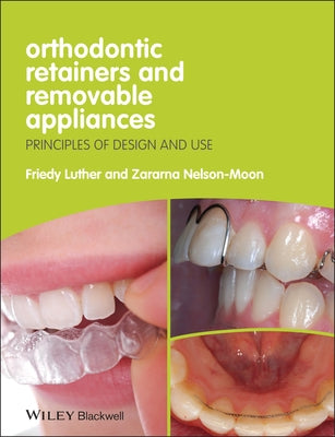 Orthodontic Retainers and Removable Appliances: Principles of Design and Use by Luther, Friedy