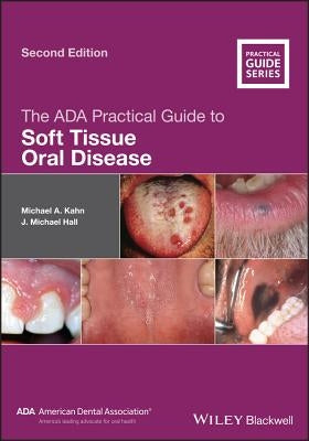 The ADA Practical Guide to Soft Tissue Oral Disease by Kahn, Michael A.