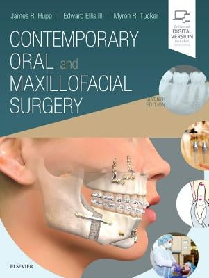 Contemporary Oral and Maxillofacial Surgery by Hupp, James R.