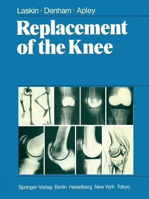Replacement of the Knee by Laskin, R. S.