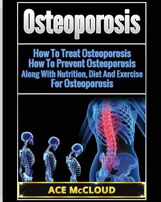 Osteoporosis: How To Treat Osteoporosis: How To Prevent Osteoporosis: Along With Nutrition, Diet And Exercise For Osteoporosis by McCloud, Ace
