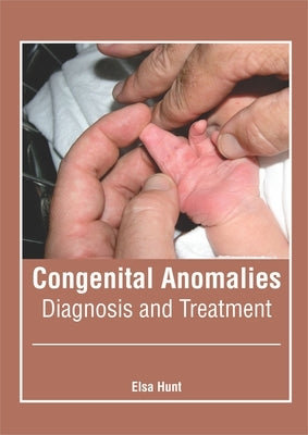 Congenital Anomalies: Diagnosis and Treatment by Hunt, Elsa