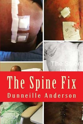 The Spine Fix: Life lessons on overcoming spinal surgery and improving your quality of life by Anderson, Dunneille D.