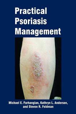 Practical Psoriasis Management by Farhangian, Michael E.