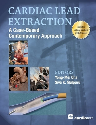 Cardiac Lead Extraction: A Case-Based Contemporary Approach by Cha, Yong-Mei
