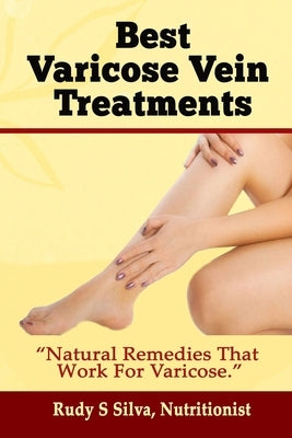 Best Varicose Vein Treatments: Natural Remedies That Work for Varicose by Silva, Rudy Silva