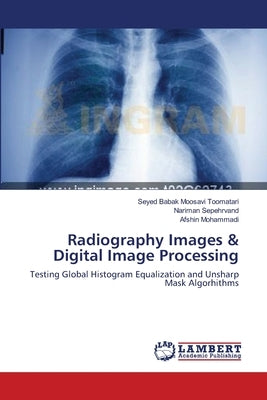Radiography Images & Digital Image Processing by Moosavi Toomatari, Seyed Babak