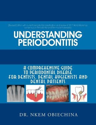 Understanding Periodontitis: A Comprehensive Guide to Periodontal Disease for Dentists, Dental Hygienists and Dental Patients by Obiechina, Dr Nkem