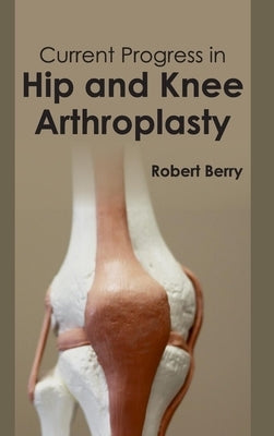 Current Progress in Hip and Knee Arthroplasty by Berry, Robert