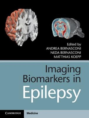 Imaging Biomarkers in Epilepsy by Bernasconi, Andrea