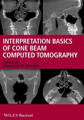 Interpretation Basics of Cone Beam Computed Tomography by Gonzalez, Shawneen M.