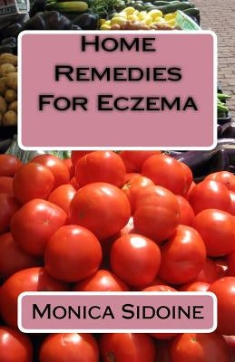 Home Remedies For Eczema by Sidoine, Monica