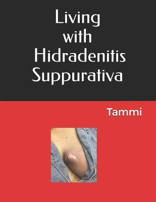 Living with Hidradenitis Suppurativa by Johnson, Tammi