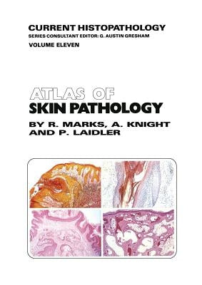 Atlas of Skin Pathology by Marks, R. M.