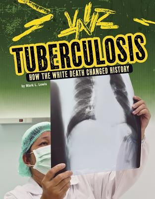 Tuberculosis: How the White Death Changed History by Lewis, Mark K.
