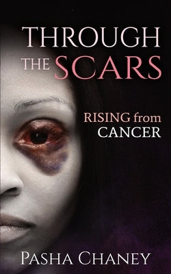 Through the Scars: Rising from Cancer by Chaney, Pasha