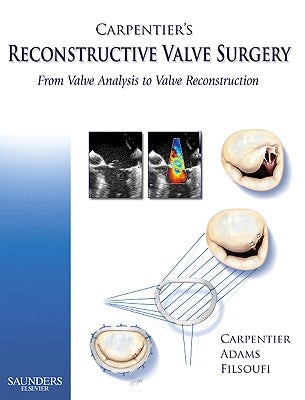 Carpentier's Reconstructive Valve Surgery: From Valve Analysis to Valve Reconstruction by Carpentier, Alain