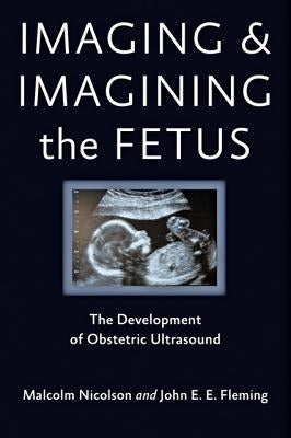 Imaging and Imagining the Fetus: The Development of Obstetric Ultrasound by Nicolson, Malcolm