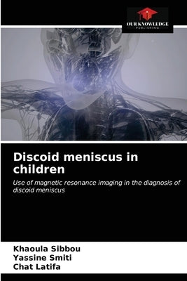 Discoid meniscus in children by Sibbou, Khaoula