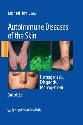 Autoimmune Diseases of the Skin: Pathogenesis, Diagnosis, Management by Hertl, Michael