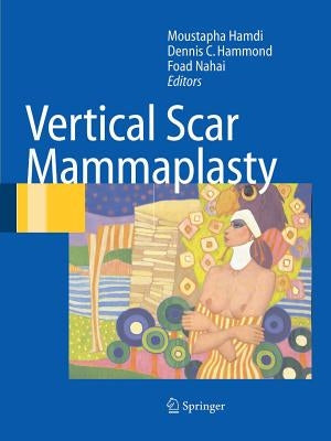 Vertical Scar Mammaplasty by Hamdi, Moustapha
