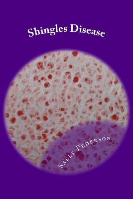 Shingles Disease: The Complete Guide by Pederson, Sally