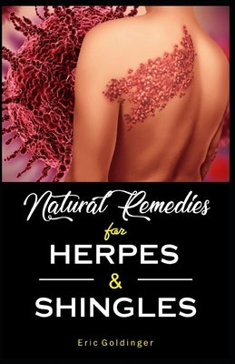 Natural Remedies For HERPES & SHINGLES: The Complete Guide by Goldinger, Eric