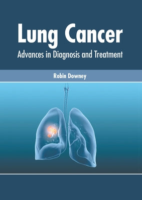 Lung Cancer: Advances in Diagnosis and Treatment by Downey, Robin