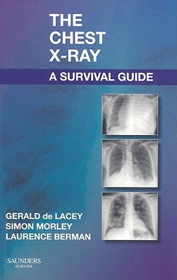 The Chest X-Ray: A Survival Guide by de Lacey, Gerald
