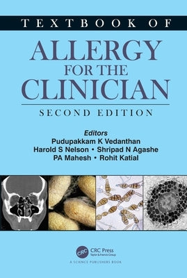 Textbook of Allergy for the Clinician by Vedanthan, Pudupakkam K.