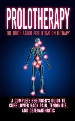 Prolotherapy: The Truth About Proliferation Therapy: A Complete Beginner's Guide to Cure Lower Back Pain, Tendinitis, And Osteoarthr by Hendrix, Arnold