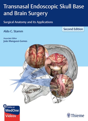 Transnasal Endoscopic Skull Base and Brain Surgery: Surgical Anatomy and Its Applications by Stamm, Aldo C.