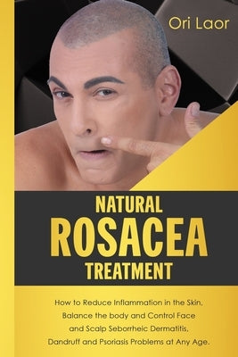 Natural Rosacea Treatment: How to Reduce Inflammation in the Skin, Balance the body and Control Face and Scalp Seborrheic Dermatitis, Dandruff an by Laor, Ori
