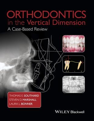 Orthodontics in the Vertical Dimension: A Case-Based Review by Southard, Thomas E.