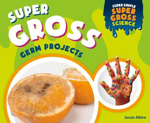 Super Gross Germ Projects by Alkire, Jessie
