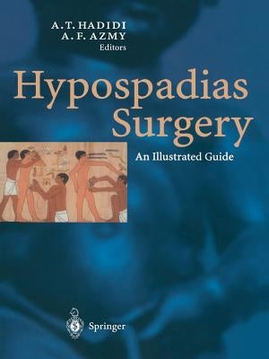 Hypospadias Surgery: An Illustrated Guide by Hadidi, Ahmed