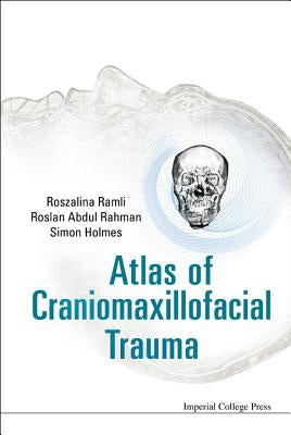 Atlas of Craniomaxillofacial Trauma by Holmes, Simon