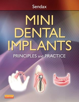 Mini Dental Implants: Principles and Practice by Sendax, Victor Dr