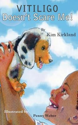 Vitiligo Doesn't Scare Me by Kirkland, Kim
