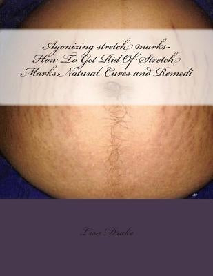 Agonizing stretch marks-How To Get Rid Of Stretch Marks: Natural Cures and Remedi by Drake, Lisa