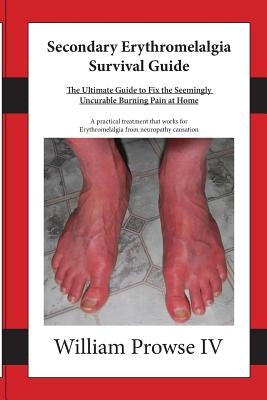 Secondary Erythromelalgia Survival Guide by Lemon, Lillie