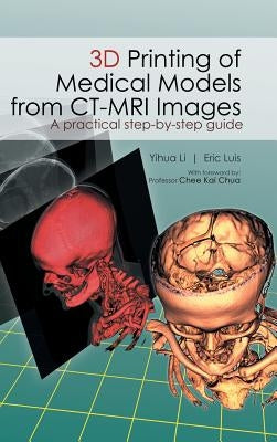 3D Printing of Medical Models from CT-MRI Images: A Practical step-by-step guide by Li Yihua